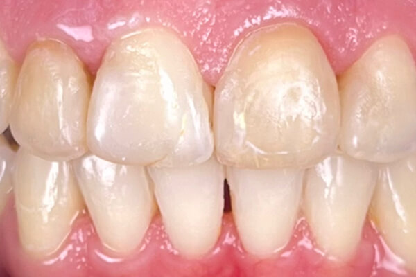 Estetinis 6 — before