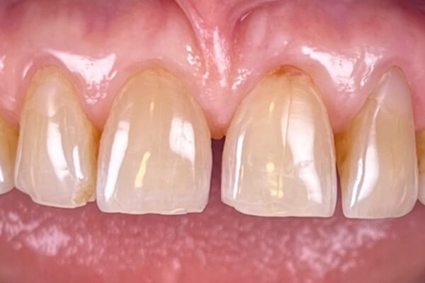 Estetinis 7 — before